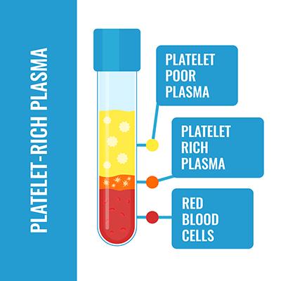 prp-therapy-allen-tx-platelet-rich-plasma-treatment prp-therapy-allen-tx-platelet-rich-plasma-treatment